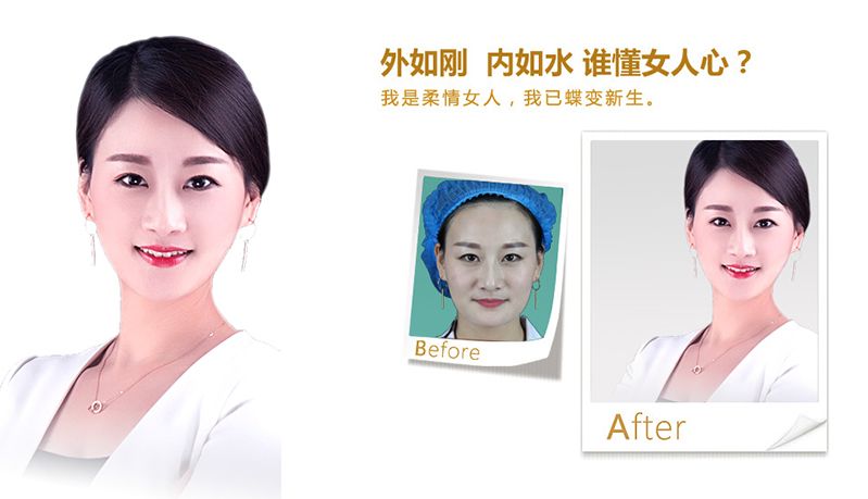 衡阳V脸、线雕隆鼻